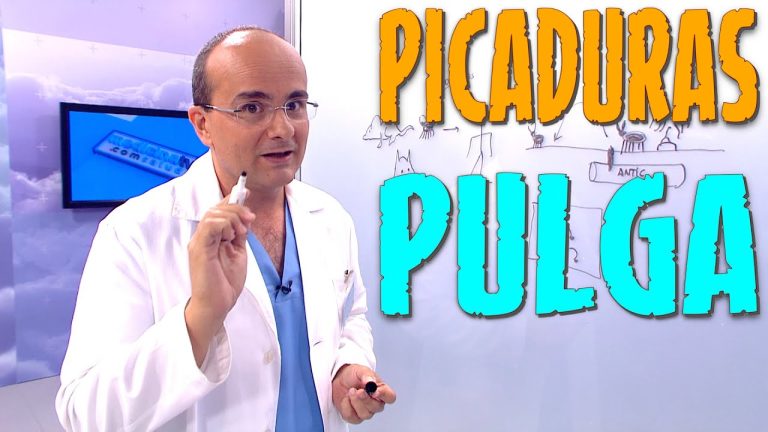 Picaduras de pulgas: S&iacute;ntomas, Tratamiento y Remedios Caseros para un Diagn&oacute;stico y Cura Eficaz